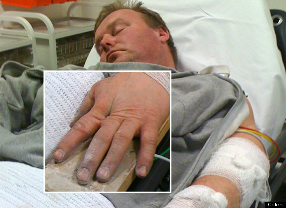 worse-ever-DIY-accidents