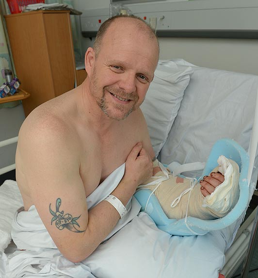 worse-ever-DIY-accidents